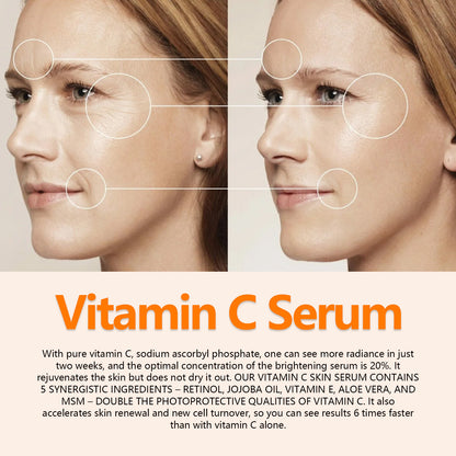 Sérum visage anti-âge à la vitamine C - Raffermissant et anti-rides